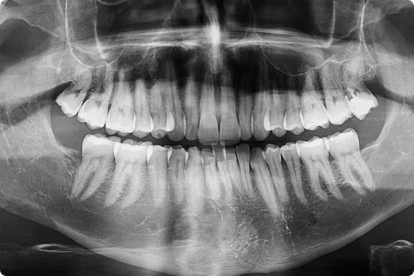 Diagnóstico Digital - Implantología Estratégica - Armonía Dentofacial