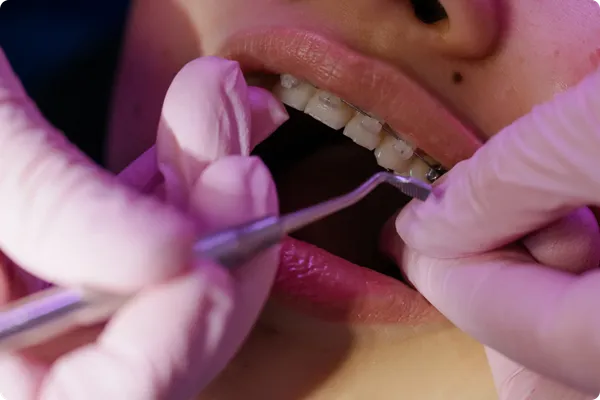 Seguimiento - Ortodoncia Ultrarápida - Armonía Dentofacial