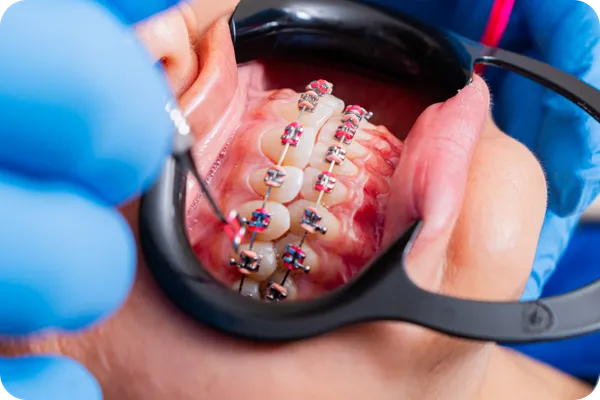 Ideal para quienes buscan eficiencia - Ortodoncia Ultrarápida - Armonía Dentofacial