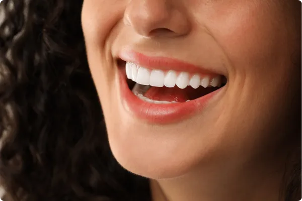 Transformación Final - Odontología Estética - Armonía Dentofacial