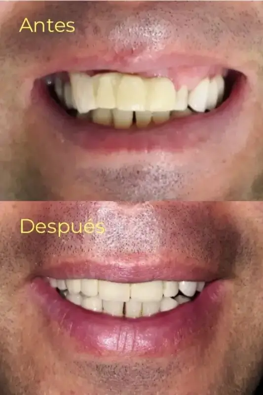 1 Casos de Exito - Armonía Dentofacial - Servicios