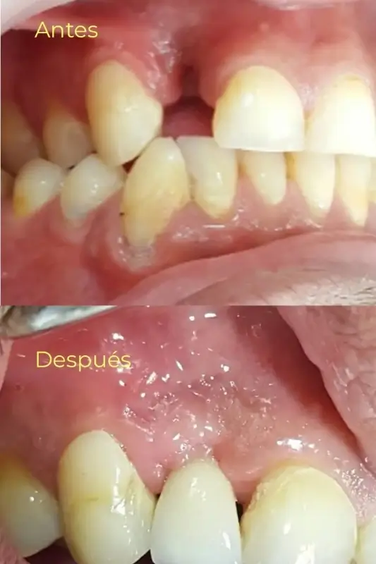 2 Casos de Exito - Armonía Dentofacial - Servicios