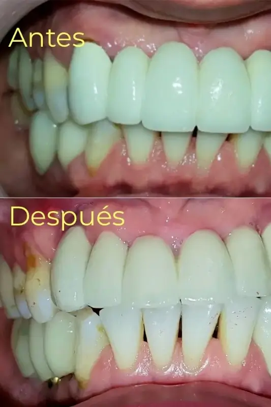 4 Casos de Exito - Armonía Dentofacial - Servicios
