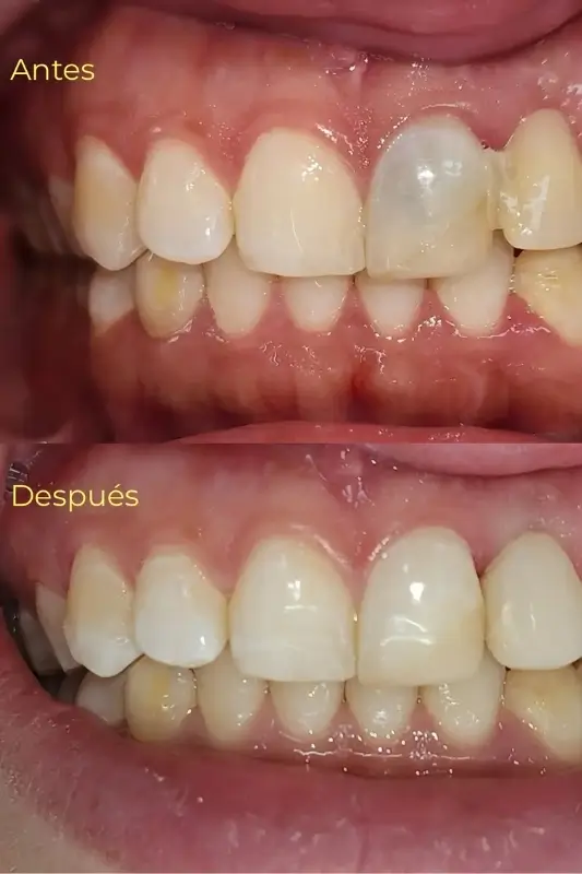 6 Casos de Exito - Armonía Dentofacial - Servicios
