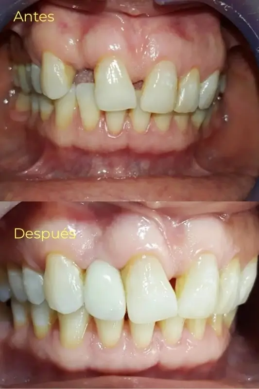 7 Casos de Exito - Armonía Dentofacial - Servicios