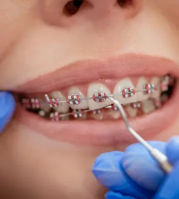 Armonía Dentofacial - Servicios - Ortodoncía